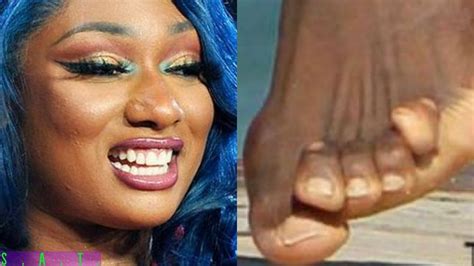 megan thee stallion feet pics|Megan Thee Stallion's Injured Foot Shown In New Graphic Photos.